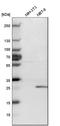 Ubiquitin C-Terminal Hydrolase L1 antibody, HPA005993, Atlas Antibodies, Western Blot image 