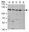 USO1 Vesicle Transport Factor antibody, PA5-30281, Invitrogen Antibodies, Western Blot image 