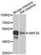 Pancreatic alpha-amylase antibody, A8045, ABclonal Technology, Western Blot image 