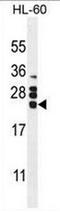Colony Stimulating Factor 2 antibody, AP51097PU-N, Origene, Western Blot image 
