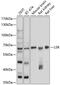 Lipolysis Stimulated Lipoprotein Receptor antibody, GTX64741, GeneTex, Western Blot image 