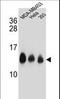 NADH:Ubiquinone Oxidoreductase Subunit C2 antibody, LS-C164810, Lifespan Biosciences, Western Blot image 