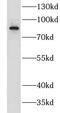 Leucine Rich Repeats And WD Repeat Domain Containing 1 antibody, FNab04867, FineTest, Western Blot image 