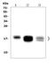 NPC Intracellular Cholesterol Transporter 2 antibody, A01582-3, Boster Biological Technology, Western Blot image 