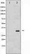 Protein Phosphatase 1 Regulatory Inhibitor Subunit 1B antibody, TA326032, Origene, Western Blot image 
