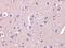 Dihydropyrimidinase-related protein 1 antibody, A05002, Boster Biological Technology, Immunohistochemistry paraffin image 