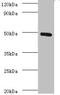 C-Type Lectin Domain Family 18 Member A antibody, A54475-100, Epigentek, Western Blot image 