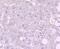Phorbol-12-myristate-13-acetate-induced protein 1 antibody, A02287-1, Boster Biological Technology, Immunohistochemistry frozen image 