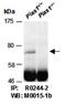 Protein Inhibitor Of Activated STAT 1 antibody, orb67014, Biorbyt, Western Blot image 