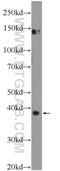 Forkhead Box R2 antibody, 14111-1-AP, Proteintech Group, Western Blot image 
