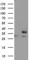 Ornithine Carbamoyltransferase antibody, TA802454AM, Origene, Western Blot image 
