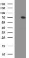 Kelch Like ECH Associated Protein 1 antibody, TA590238, Origene, Western Blot image 