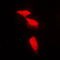 Protein Phosphatase 2 Regulatory Subunit B'Alpha antibody, LS-C352694, Lifespan Biosciences, Immunofluorescence image 