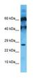 Uncharacterized protein C10orf131 antibody, orb327157, Biorbyt, Western Blot image 