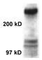 CREB Binding Protein antibody, ab2832, Abcam, Western Blot image 
