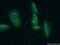 Echinoderm microtubule-associated protein-like 4 antibody, 22709-1-AP, Proteintech Group, Immunofluorescence image 