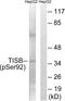 ZFP36 Ring Finger Protein Like 1 antibody, AP55733PU-S, Origene, Western Blot image 