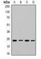 Charged multivesicular body protein 1b antibody, orb341456, Biorbyt, Western Blot image 