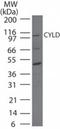 Ubiquitin carboxyl-terminal hydrolase CYLD antibody, TA336362, Origene, Western Blot image 