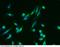 Nicastrin antibody, 11183-R004, Sino Biological, Immunohistochemistry paraffin image 