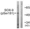 SRY-Box 9 antibody, TA311627, Origene, Western Blot image 