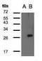 Lysophospholipase 1 antibody, GTX104398, GeneTex, Western Blot image 