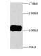 Inositol-Trisphosphate 3-Kinase B antibody, FNab04423, FineTest, Western Blot image 