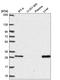 Methenyltetrahydrofolate Synthetase antibody, HPA054177, Atlas Antibodies, Western Blot image 