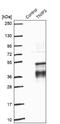 TNFAIP3 Interacting Protein 3 antibody, NBP1-89305, Novus Biologicals, Western Blot image 