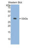 Iduronate 2-Sulfatase antibody, LS-C294565, Lifespan Biosciences, Western Blot image 