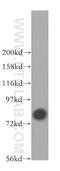 TRIO And F-Actin Binding Protein antibody, 16124-1-AP, Proteintech Group, Western Blot image 