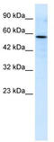 RUN And FYVE Domain Containing 3 antibody, TA335607, Origene, Western Blot image 
