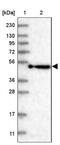 Kelch Repeat And BTB Domain Containing 4 antibody, NBP2-38363, Novus Biologicals, Western Blot image 