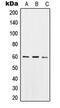 Sorting Nexin 4 antibody, GTX55902, GeneTex, Western Blot image 