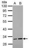 Leucine Rich Repeat Containing 19 antibody, GTX123305, GeneTex, Western Blot image 