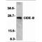 Cell Death Inducing DFFA Like Effector B antibody, LS-C299, Lifespan Biosciences, Western Blot image 