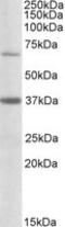 Carnitine O-palmitoyltransferase 2, mitochondrial antibody, LS-C108929, Lifespan Biosciences, Western Blot image 