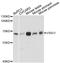 V-Set And Immunoglobulin Domain Containing 1 antibody, A12873, Boster Biological Technology, Western Blot image 