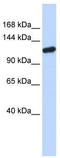 Piwi Like RNA-Mediated Gene Silencing 4 antibody, TA338844, Origene, Western Blot image 