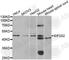 Eukaryotic Translation Initiation Factor 2 Subunit Beta antibody, A5894, ABclonal Technology, Western Blot image 