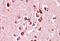 Unc-5 Netrin Receptor C antibody, NBP1-37002, Novus Biologicals, Immunohistochemistry frozen image 