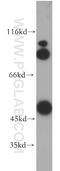 Glucokinase antibody, 19666-1-AP, Proteintech Group, Western Blot image 