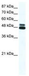 Cholinergic Receptor Nicotinic Beta 2 Subunit antibody, TA330426, Origene, Western Blot image 