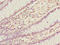 Chromodomain Helicase DNA Binding Protein 1 antibody, A68314-100, Epigentek, Immunohistochemistry paraffin image 