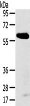 Spermatogenesis Associated 18 antibody, CSB-PA308950, Cusabio, Western Blot image 