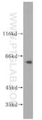 Polypeptide N-Acetylgalactosaminyltransferase 14 antibody, 16939-1-AP, Proteintech Group, Western Blot image 