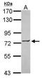 Zinc Finger Protein 443 antibody, GTX115372, GeneTex, Western Blot image 