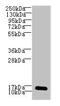 LSM7 Homolog, U6 Small Nuclear RNA And MRNA Degradation Associated antibody, CSB-PA890731LA01HU, Cusabio, Western Blot image 