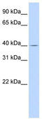 Solute carrier family 22 member 18 antibody, TA334054, Origene, Western Blot image 