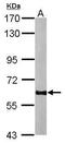 Glutamate Decarboxylase 2 antibody, PA5-21297, Invitrogen Antibodies, Western Blot image 